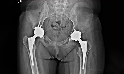 Post-Surgery Recovery